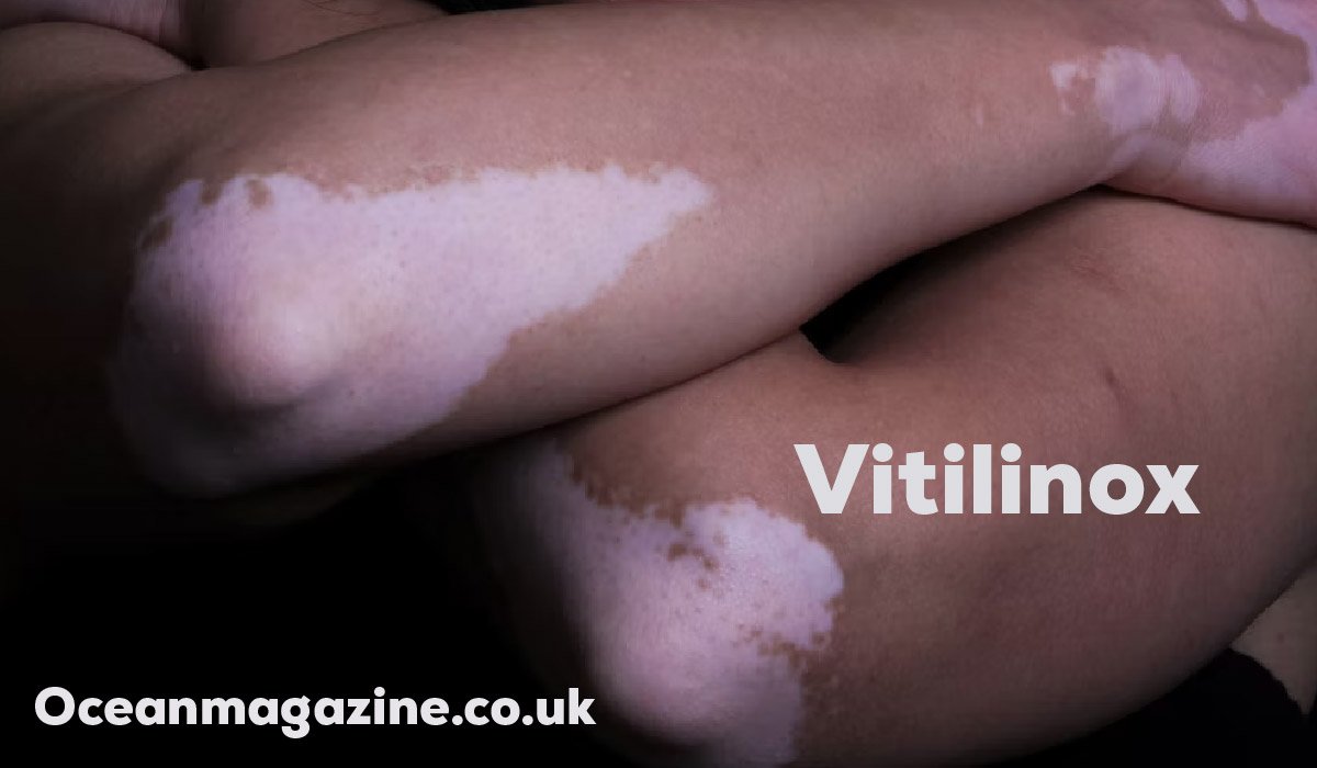 Vitilinox